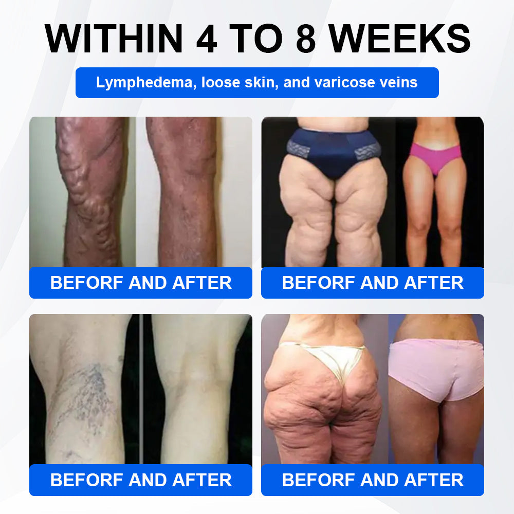 Nano Microneedle Patch with Collagen & Motrixyl 3000 丨Obesity,Cardiovascular Diseas, Diabetes, Sleep Apnea, Joint Problems and More