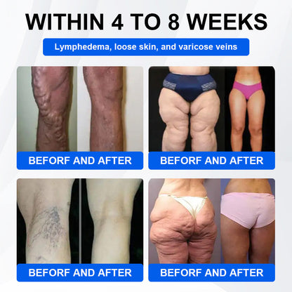 Nano Microneedle Patch with Collagen & Motrixyl 3000 丨Obesity,Cardiovascular Diseas, Diabetes, Sleep Apnea, Joint Problems and More