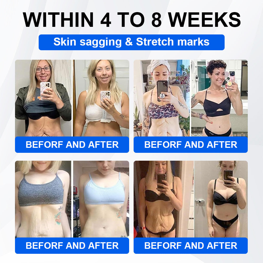 Nano Microneedle Patch with Collagen & Motrixyl 3000 丨Obesity,Cardiovascular Diseas, Diabetes, Sleep Apnea, Joint Problems and More