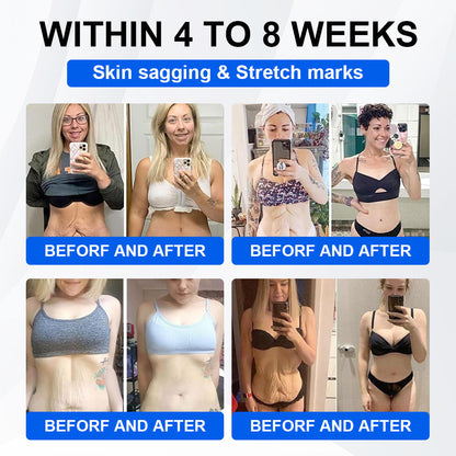 Nano Microneedle Patch with Collagen & Motrixyl 3000 丨Obesity,Cardiovascular Diseas, Diabetes, Sleep Apnea, Joint Problems and More