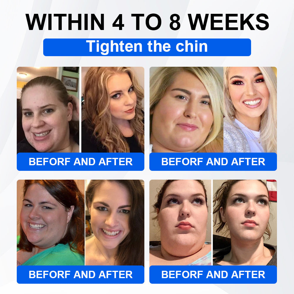 Nano Microneedle Patch with Collagen & Motrixyl 3000 丨Obesity,Cardiovascular Diseas, Diabetes, Sleep Apnea, Joint Problems and More