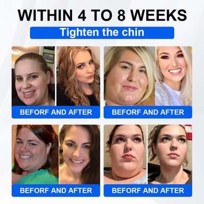 Nano Microneedle Patch with Collagen & Motrixyl 3000 丨Obesity,Cardiovascular Diseas, Diabetes, Sleep Apnea, Joint Problems and More