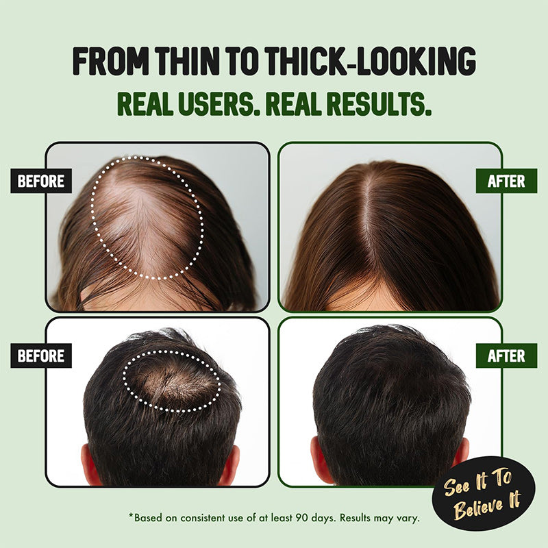 ⏳🔥 Last Day Discount!💧 Hair Growth Spray – Biotin & Caffeine