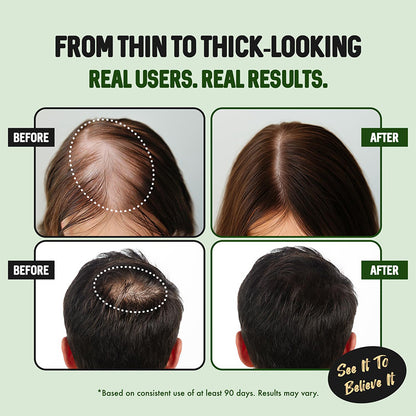 ⏳🔥 Last Day Discount!💧 Hair Growth Spray – Biotin & Caffeine