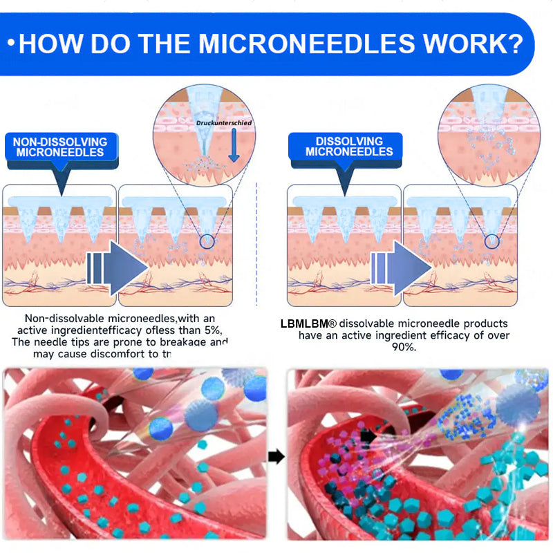 Nano Microneedle Patch with Collagen & Motrixyl 3000 丨Obesity,Cardiovascular Diseas, Diabetes, Sleep Apnea, Joint Problems and More