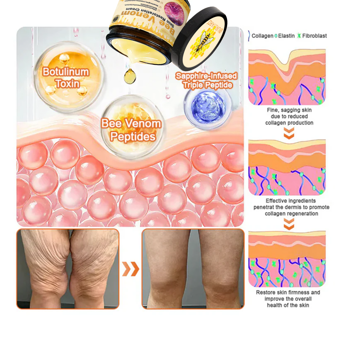 💕FDA Approved: Bee venom Pro Comprehensive Cream