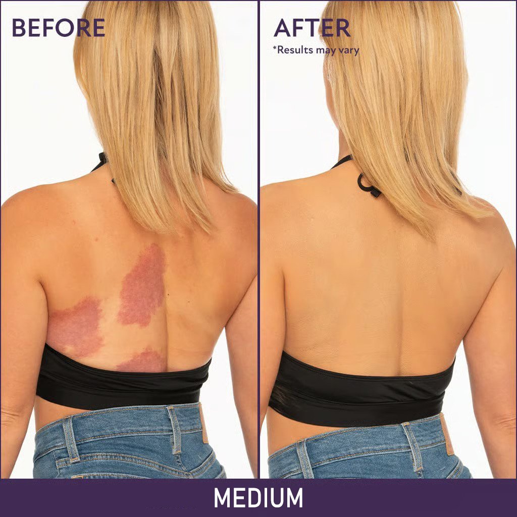 3-in-1 Concealer Hydrates, covers, color-corrects. 12H waterproof & smudge-proof. 🎁