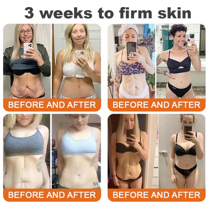 💕FDA Approved: Bee venom Pro Comprehensive Cream