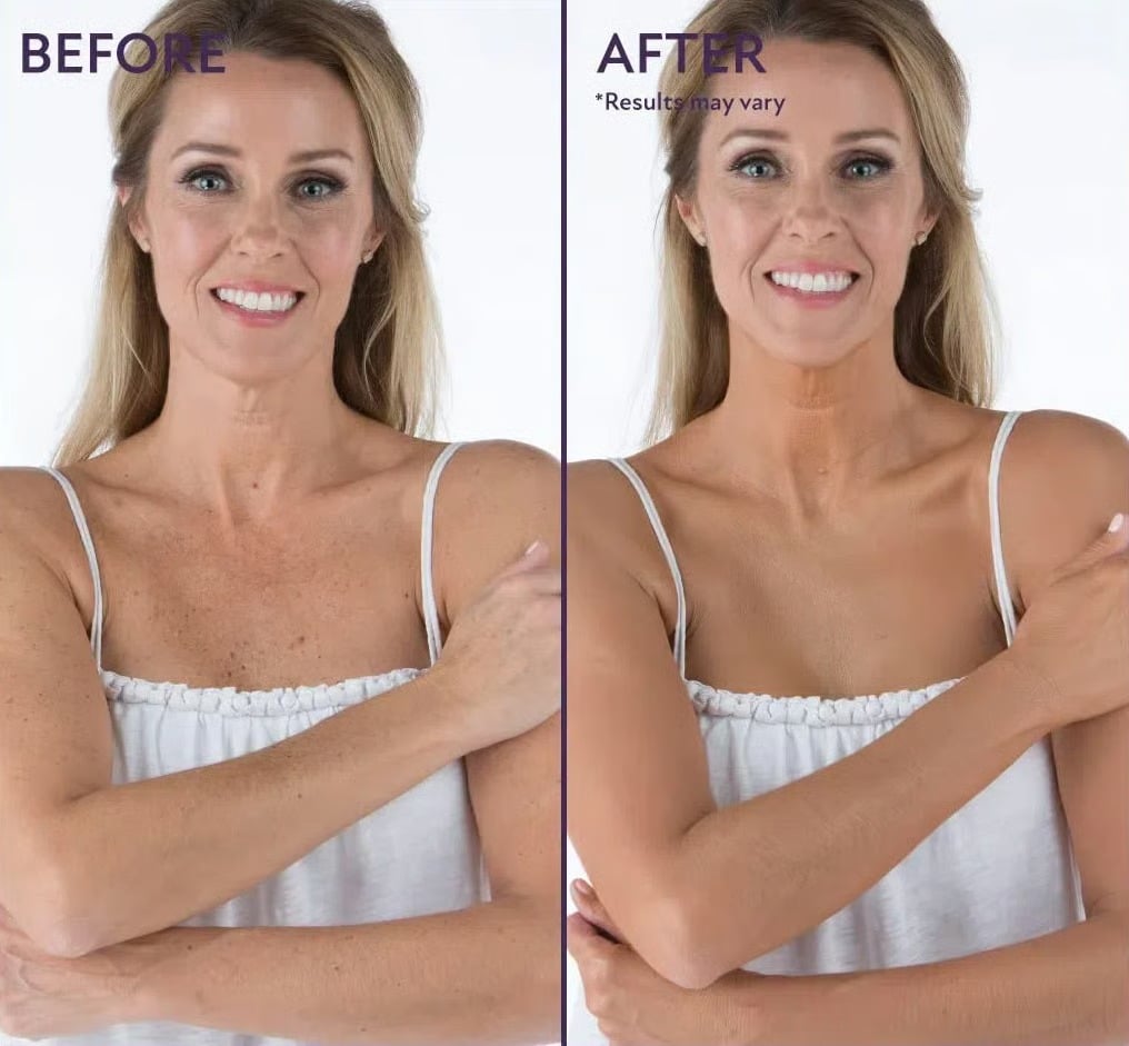 3-in-1 Concealer Hydrates, covers, color-corrects. 12H waterproof & smudge-proof. 🎁