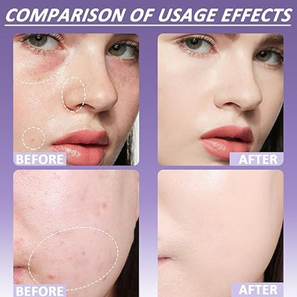 3-in-1 Concealer Hydrates, covers, color-corrects. 12H waterproof & smudge-proof. 🎁